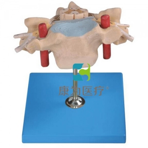 “康為醫(yī)療”頸椎附脊髓和脊神經(jīng)放大模型