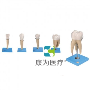 “康為醫(yī)療”牙放大模型