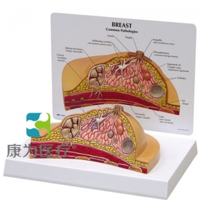 “康為醫(yī)療”醫(yī)患關系溝通模型-乳房橫斷切面模型 （醫(yī)學指導模型）