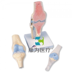 膝關節(jié)截面模型，3部分